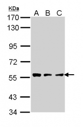GTX113404 - Tripeptidyl-peptidase 1 (TPP1)
