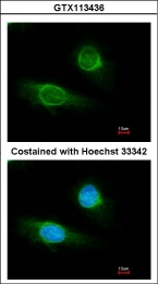 GTX113436 - Fibrinogen gamma chain