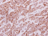 GTX113467 - Isocitric dehydrogenase gamma / IDH3G