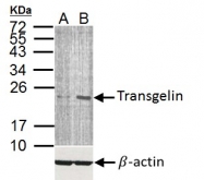GTX113561 - Transgelin (TAGLN)