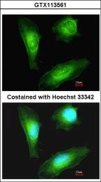 GTX113561 - Transgelin (TAGLN)