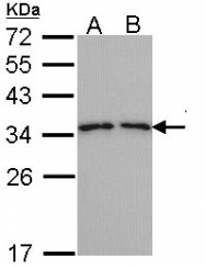 GTX113568 - Tropomyosin-3 (TPM3)