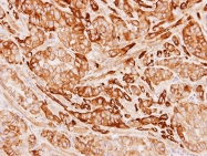 GTX113857 - Tropomyosin-1 (TPM1)