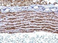 GTX113857 - Tropomyosin-1 (TPM1)