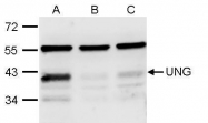 GTX113860 - Uracil-DNA glycosylase (UNG)