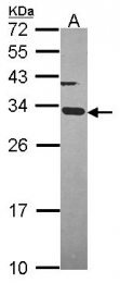 GTX114275 - ATP synthase subunit gamma