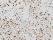 GTX114483 - Islet cell autoantigen 1 / ICA1
