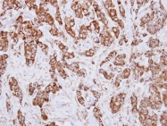 GTX114486 - Isocitric dehydrogenase alpha / IDH3A