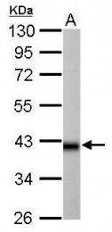 GTX114486 - Isocitric dehydrogenase alpha / IDH3A