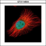 GTX114584 - NFKBIB / IKBB