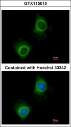 GTX115015 - VARS (Valyl-tRNA synthetase)
