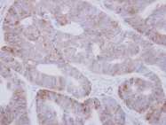 GTX115015 - VARS (Valyl-tRNA synthetase)