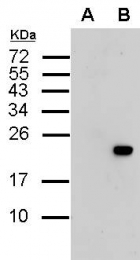 GTX115045 - 6xHistidine Epitope Tag