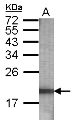 GTX115434 - Ubiquitin D (UBD)
