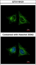 GTX116121 - Heme-binding protein 1 / HEBP1