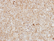 GTX116121 - Heme-binding protein 1 / HEBP1