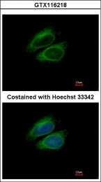 GTX116218 - UNR protein / CSDE1