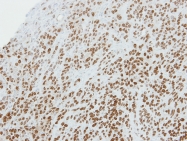 GTX119107 - Ribonuclease UK114 / HRSP12
