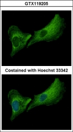 GTX119205 - Deoxyribonuclease-2-beta