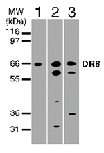 GTX11933 - TNFRSF21 / Death receptor 6 (DR6)