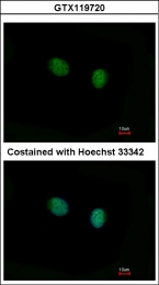 GTX119720 - Estrogen receptor beta