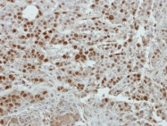 GTX119720 - Estrogen receptor beta