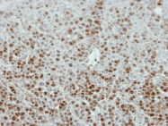 GTX119721 - Estrogen receptor beta
