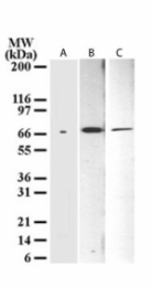 GTX11997 - Tumor protein p73 (TP73)