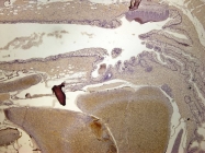 GTX124295 - Zebrafish Nucleoside diphosphate kinase