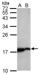 GTX124295 - Zebrafish Nucleoside diphosphate kinase