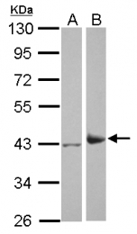 GTX124319 - Isocitric dehydrogenase alpha / IDH3A
