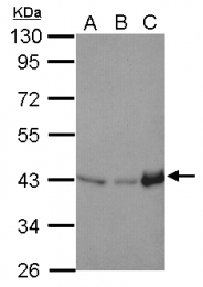 GTX124431 - Isocitric dehydrogenase alpha / IDH3A