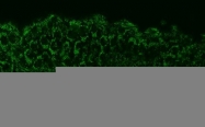 GTX124482 - Zebrafish aldh2a