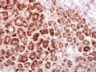 GTX128013 - mHMG-CoA synthase / HMGCS2