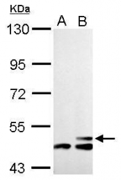 GTX128013 - mHMG-CoA synthase / HMGCS2