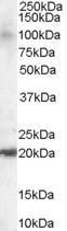 GTX13618 - ARL6IP5 / JWA
