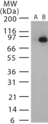 GTX13805 - Bacillus anthracis lethal factor