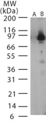 GTX13806 - Bacillus anthracis lethal factor