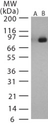 GTX13807 - Bacillus anthracis lethal factor