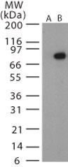 GTX13808 - Bacillus anthracis protective antigen