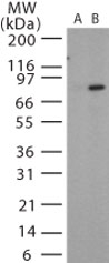 GTX13809 - Bacillus anthracis protective antigen