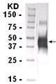 GTX14016 - Erythropoietin / EPO