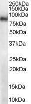 GTX14749 - MID2 / RNF60