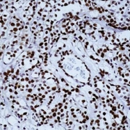 GTX17119 - Retinoblastoma-associated protein / RB1