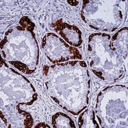 GTX17152 - pan Cytokeratin
