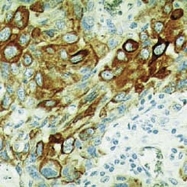 GTX20849 - pan Cytokeratin