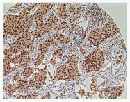 GTX21287 - Aurora kinase A