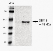 GTX21287 - Aurora kinase A