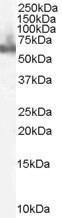 GTX21357 - DOK3
