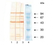 GTX21993 - Bacillus anthracis protective antigen